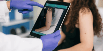 Melanoma Day: 1700 casi diagnosticati nel 2024
