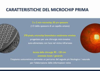 Microchip nella retina, 80% pazienti sottoposti a trial clinico tornato a leggere
